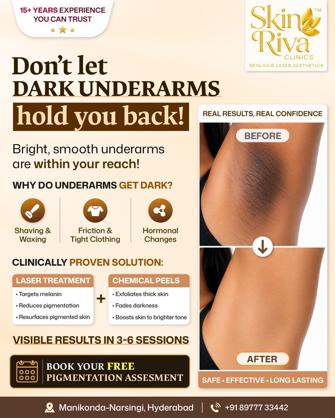 Skin Riva Instagram post on acne care